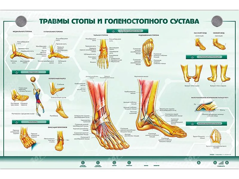 Стенд Зарница травмы стопы и голеностопного сустава