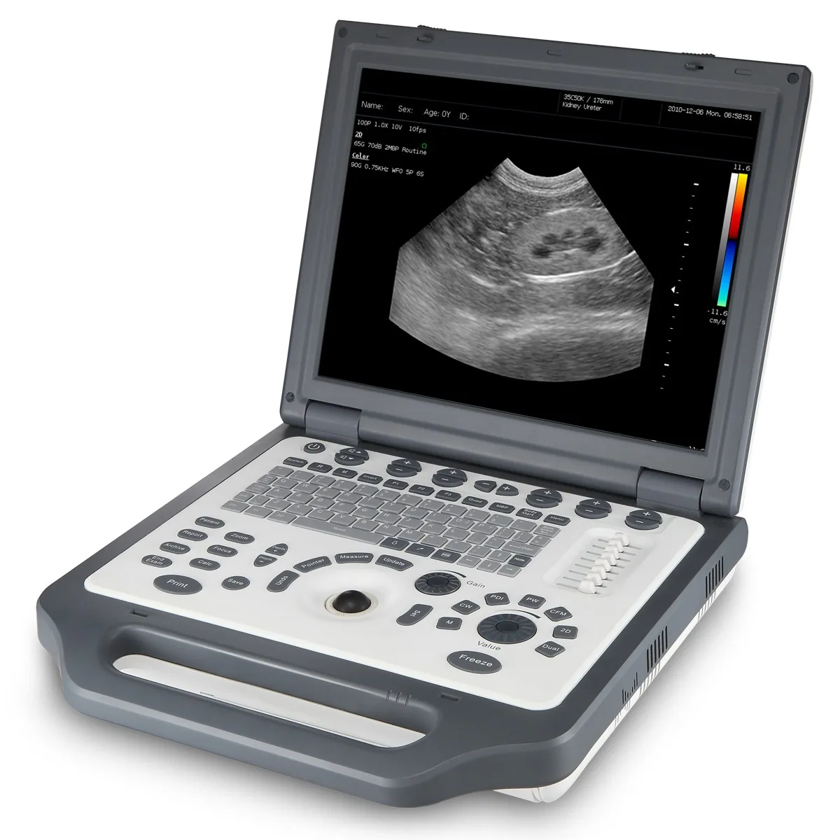 Ветеринарный цветной допплер Shinova DopScan G3V